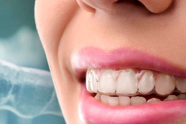 INVISALIGN